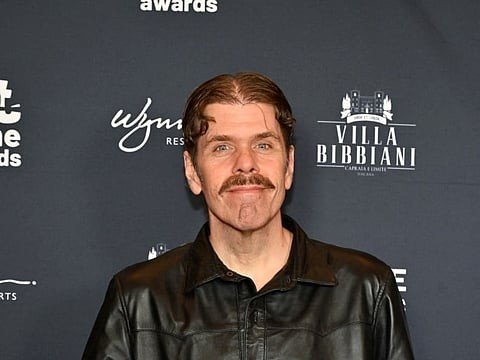 Perez Hilton's Health Update: Family Says There is Reason for Hope