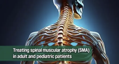 Spinal Muscular Atrophy: Health experts extend support to Indian-made generic drug